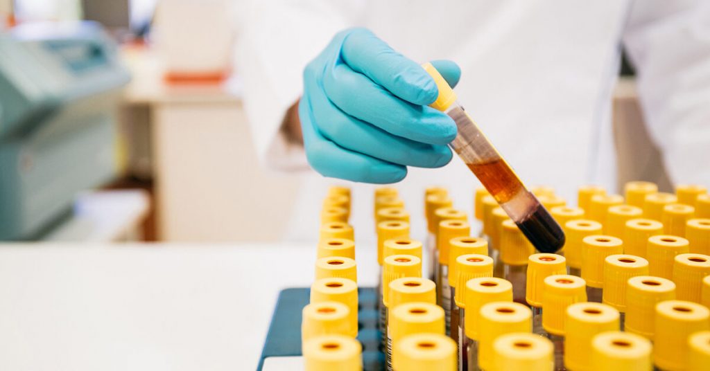 Here's The List Of Do's And Don't Before A Blood Test Green Live